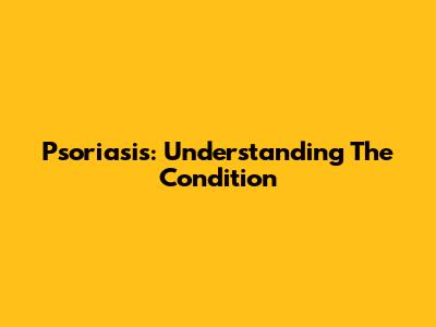 Psoriasis: Understanding The Condition